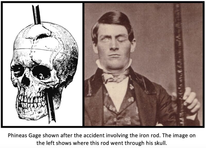 Phineas Gage Phineas Gage