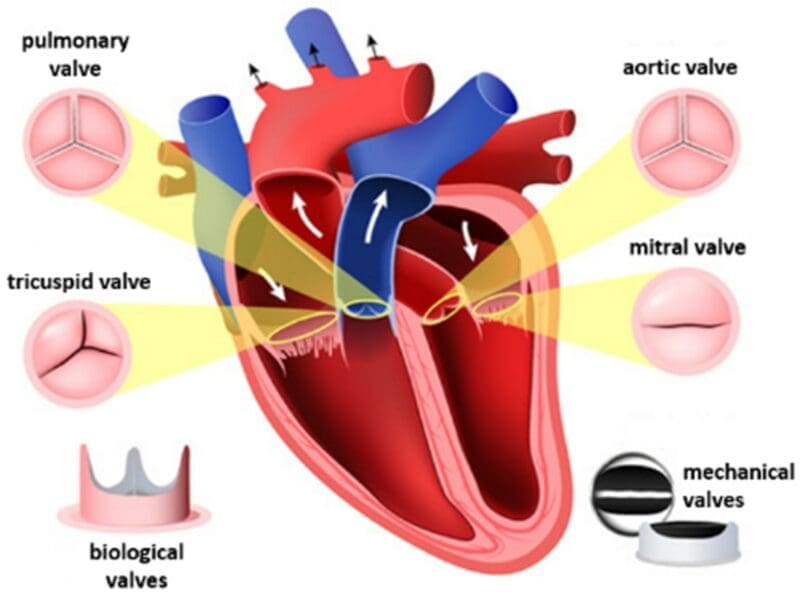 Heart Valves Heart Valves