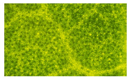 Stomata photograph Stomata photograph