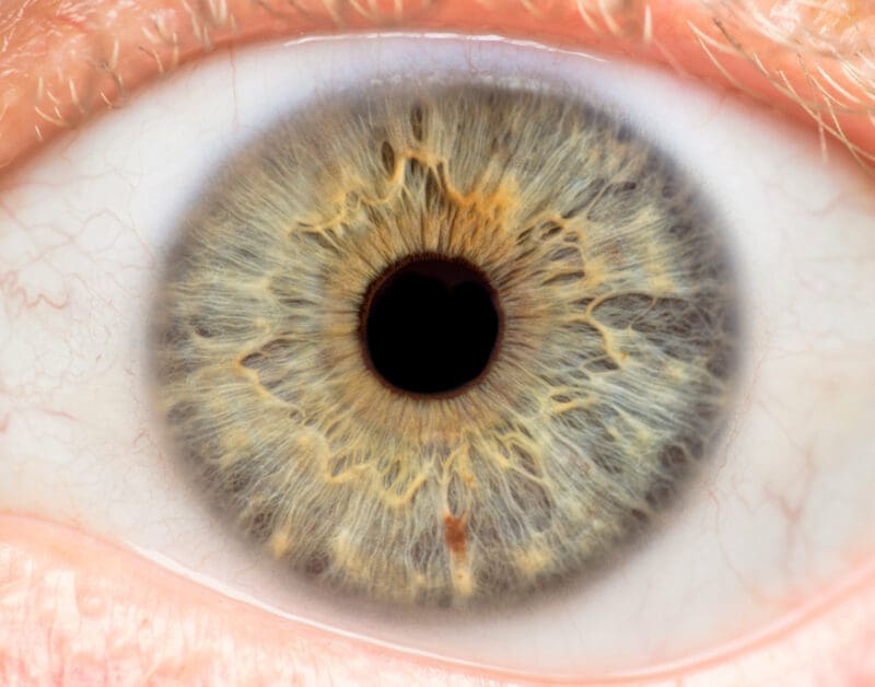 The human eye