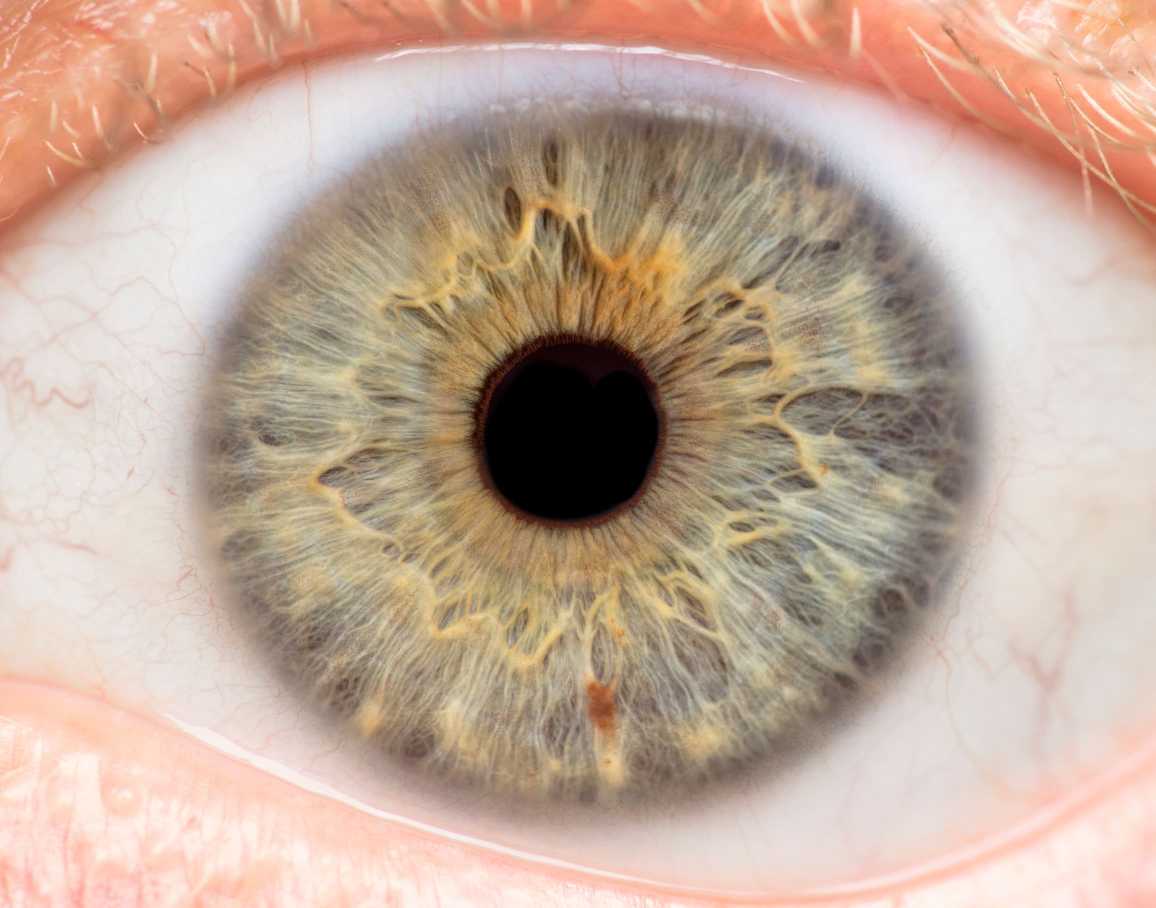 The human eye