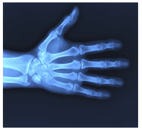 X- ray