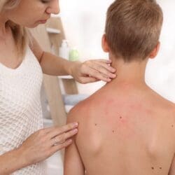 TQUK Level 2 Certificate in Allergy Awareness (Children)