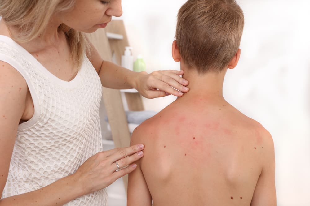 TQUK Level 2 Certificate in Allergy Awareness (Children)