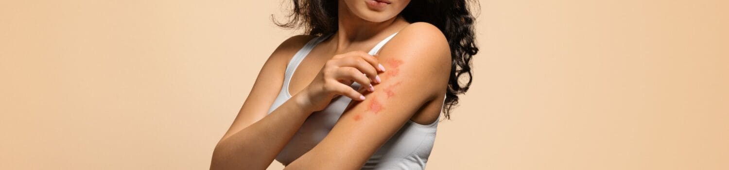A Guide to Allergens in Healthcare A Guide to Allergens in Healthcare